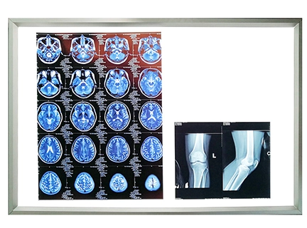 X-ray View Box